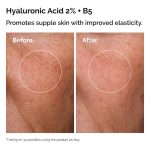 the ordinary pakistan original skin support set hyaluronic acid
