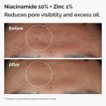 the ordinary pakistan original skin support set niacinamide