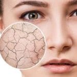 theordinary dryness & dehydration