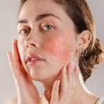 look of redness Theordinary