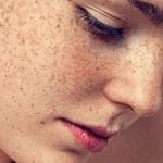theordinary melasma