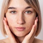 theordinary signs of congestion