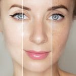 best skincare for uneven skin tone