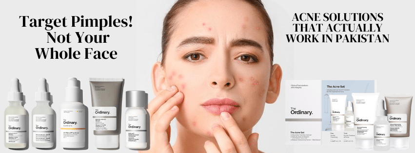 Best spot treatment for acne and Pimples in Pakistan using The Ordinary