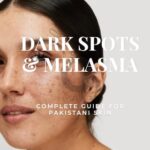 Melasma-treatment-routine-in-Pakistan-using-The-original-Ordinary-products Pigmentation