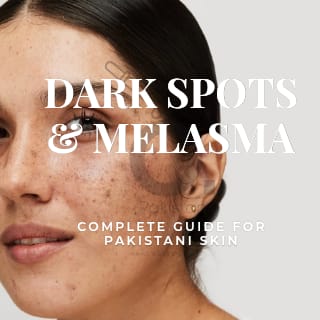 Melasma-treatment-routine-in-Pakistan-using-The-original-Ordinary-products Pigmentation