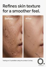 The Ordinary Caffeine 3% + Escin 1% Face Serum texture before and after