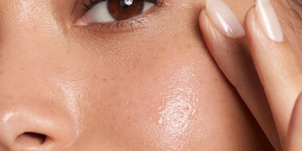 Oily skin skincare guide for Pakistan with Niacinamide 10% Zinc 1%
