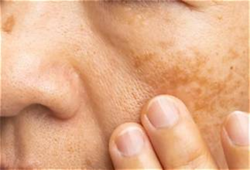 Alpha Arbutin 2% HA for pigmentation and dark spots skincare Pakistan